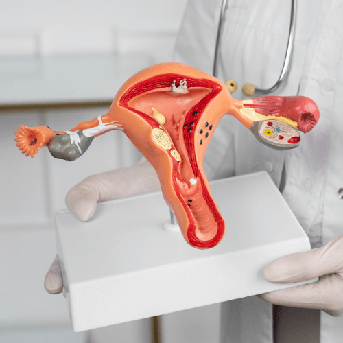 Thumbnail for Understanding Cervical Cancer and Massage